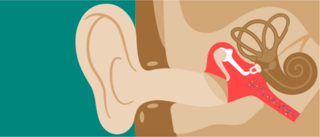 Otitis media aguda (OMA)
